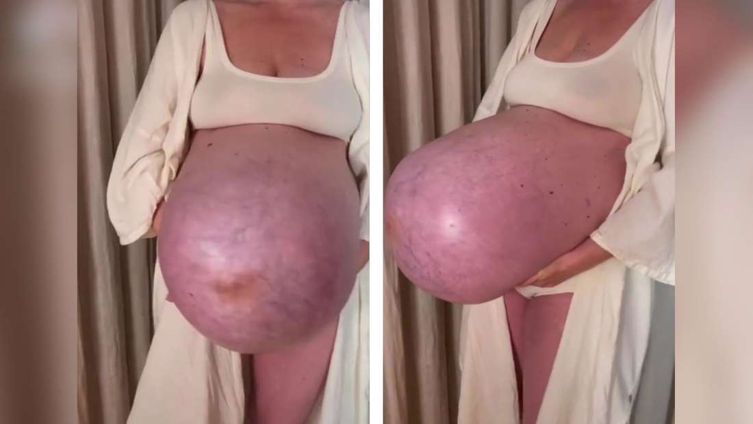 Screenshot zeigt eine Frau, die mit Drillingen schwanger ist